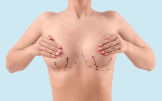 Breast Lift Surgery Ankara, Turkey