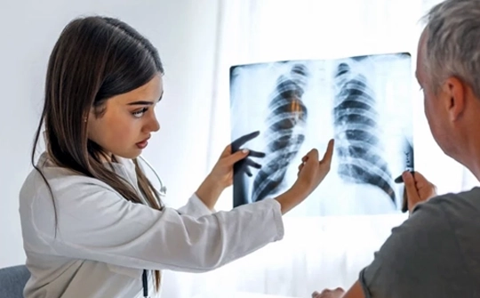 Endobronchial Ultrasound (EBUS)